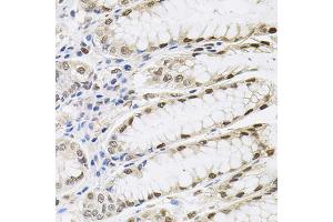 Immunohistochemistry of paraffin-embedded human stomach using SRSF9 antibody (ABIN5973601) (40x lens). (SFRS9 antibody)