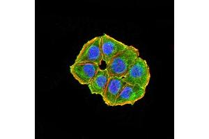 Immunofluorescence (IF) image for anti-ARD1 Homolog, N-Acetyltransferase (ARD1A) (AA 111-235) antibody (ABIN5611233)