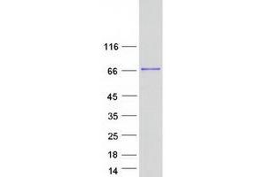 Validation with Western Blot (METTL3 Protein (Myc-DYKDDDDK Tag))