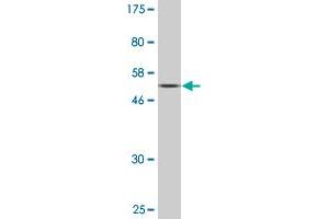 Western Blot detection against Immunogen (60. (BST1 antibody  (AA 1-318))