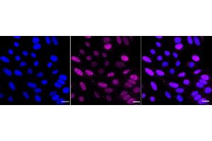 Immunocytochemical staining of HepG2 cells with RAD23A antibody (ABIN7800116), 1:1,000). (Recombinant RAD23A antibody)