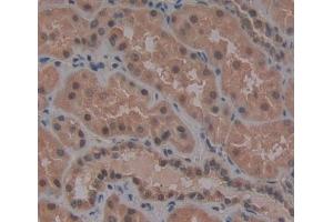 #VALUE! (WT1 antibody  (AA 310-446))