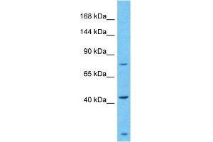Host:  Rabbit  Target Name:  ZSC29  Sample Type:  Fetal Liver lysates  Antibody Dilution:  1. (ZSCAN29 antibody  (C-Term))