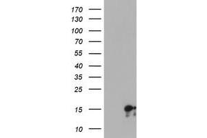 HEK293T cells were transfected with the pCMV6-ENTRY control (Left lane) or pCMV6-ENTRY SYNJ2BP (Right lane) cDNA for 48 hrs and lysed. (SYNJ2BP antibody)