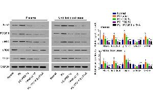 Fasudil regulates the expression of RhoA, ROCK, p-MLC, eNOS and VEGF in placenta and umbilical vessel from PE miceWestern blot analysis for RhoA, ROCK, p-MLC, eNOS and VEGF in mice placenta and umbilical vessel, and quantification. (VEGFA antibody  (AA 81-132))