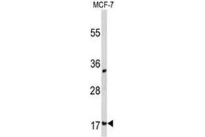 Western blot analysis of Destrin  Antibody  in MCF-7 cell line lysates (35ug/lane). (Destrin antibody  (Middle Region))