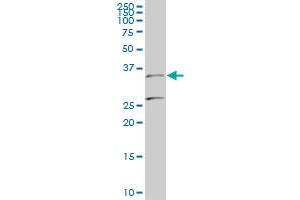 BARHL1 monoclonal antibody (M01), clone 2B11 Western Blot analysis of BARHL1 expression in PC-12 . (BARHL1 antibody  (AA 55-154))