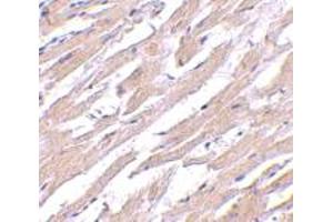 Immunohistochemical staining of human heart tissue with 2.
