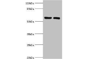 Western blot All lanes: ADP-ribosylation factor-binding protein GGA2 antibody at 10 μg/mL Lane 1: Rat brain tissue Lane 2: Mouse liver tissue Secondary Goat polyclonal to rabbit IgG at 1/10000 dilution Predicted band size: 67 kDa Observed band size: 67 kDa (GGA2 antibody  (AA 1-300))