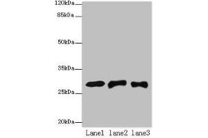 Western blot All lanes: ETHE1 antibody at 8 μg/mL Lane 1: Mouse liver tissue Lane 2: HepG2 whole cell lysate Lane 3: Hela whole cell lysate Secondary Goat polyclonal to rabbit IgG at 1/10000 dilution Predicted band size: 28 kDa Observed band size: 28 kDa (ETHE1 antibody  (AA 8-254))