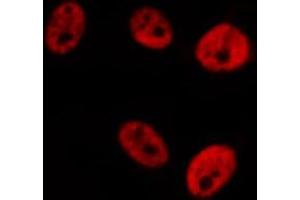 ABIN6276281 staining  Hela cells by IF/ICC. (STAT1 antibody  (C-Term))