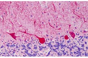 Human Cerebellum: Formalin-Fixed, Paraffin-Embedded (FFPE) (CARD11 antibody  (AA 18-238))