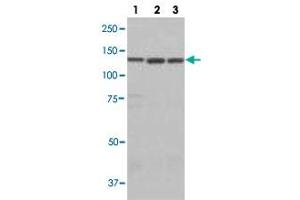 Western blot analysis of lane 1: A549 cell lysate, lane 2: HEK293 cell lysate and lane 3: HeLa cell lysate using LARS polyclonal antibody . (LARS antibody)