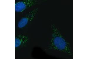 anti-NADPH Oxidase 4 (NOX4) antibody