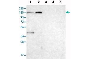 Western blot analysis of Lane 1: RT-4, Lane 2: U-251 MG, Lane 3: Human Plasma, Lane 4: Liver, Lane 5: Tonsil with C6orf170 polyclonal antibody  at 1:100 - 1:250 dilution.