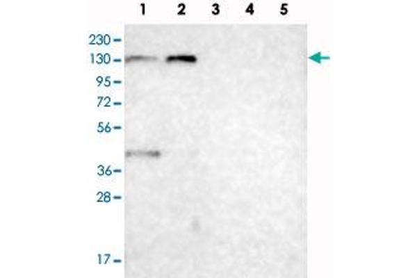Chromosome 6 Open Reading Frame 170 (C6ORF170) anticorps