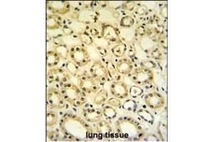 H6PD Antibody (C-term) (ABIN651229 and ABIN2840142) IHC analysis in formalin fixed and paraffin embedded lung tissue followed by peroxidase conjugation of the secondary antibody and DAB staining. (Glucose-6-Phosphate Dehydrogenase antibody  (C-Term))