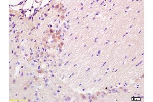 Formalin-fixed and paraffin embedded rat brain labeled with Rabbit Anti BBC3/PUMA Polyclonal Antibody, Unconjugated (ABIN731528) at 1:200 followed by conjugation to the secondary antibody and DAB staining