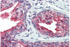 Human, Prostate: Formalin-Fixed Paraffin-Embedded (FFPE) (CDCP1 antibody  (N-Term))