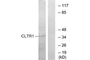 Western blot analysis of extracts from COS7 cells, using CLTR1 Antibody. (CysLTR1 antibody  (AA 131-180))