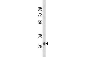 Western Blotting (WB) image for anti-Secreted Frizzled-Related Protein 1 (SFRP1) antibody (ABIN3004008) (SFRP1 antibody)