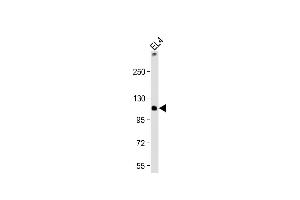 Anti-TCIRG1 Antibody (C-Term) at 1:2000 dilution + EL4 whole cell lysate Lysates/proteins at 20 μg per lane.