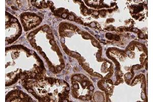ABIN6272433 at 1/100 staining Human kidney tissue by IHC-P. (SPHK2 antibody  (N-Term))