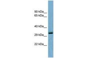 Image no. 1 for anti-OTU Domain Containing 6B (OTUD6B) (C-Term) antibody (ABIN6741941) (OTUD6B antibody  (C-Term))