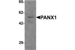 Western blot analysis of PANX1 in human ovary tissue lysate with PANX1 Antibody  at 1 μg/ml. (PANX1 antibody  (N-Term))