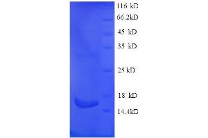 SDS-PAGE (SDS) image for Chemokine (C-C Motif) Ligand 20 (CCL20) (AA 27-96) protein (GST tag) (ABIN5709215)