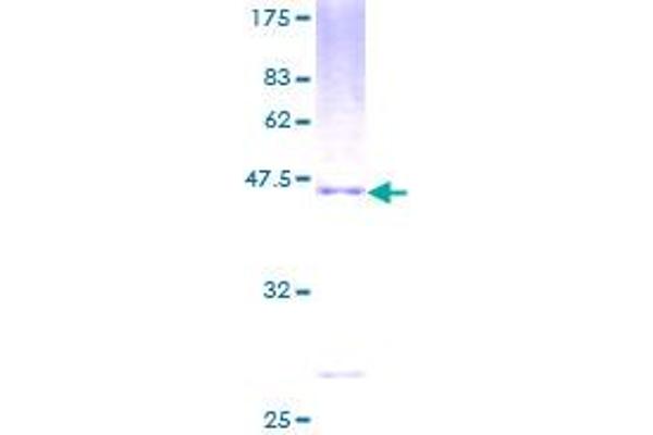 PMCH Protein (AA 1-165) (GST tag)