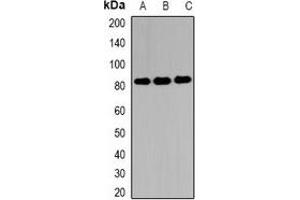 Western blot analysis of EIF4B expression in MCF7 (A), 22RV1 (B), Hela (C) whole cell lysates. (EIF4B antibody)