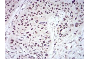 Immunohistochemistry (IHC) image for anti-Wilms Tumor 1 Associated Protein (WTAP) (AA 91-201) antibody (ABIN5880136)