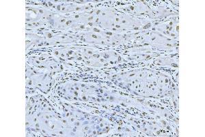 IHC analysis of MRE11 using anti-MRE11 antibody (ABIN7600025). (Mre11 antibody  (AA 14-481))