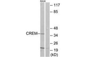 Western Blotting (WB) image for anti-CAMP Responsive Element Modulator (CREM) (AA 81-130) antibody (ABIN2889545) (CREM antibody  (AA 81-130))