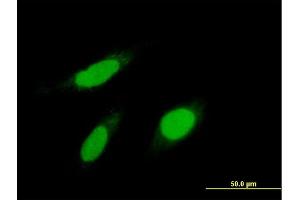 Immunofluorescence of purified MaxPab antibody to KPNA1 on HeLa cell. (KPNA1 antibody  (AA 1-538))