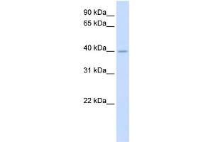 WB Suggested Anti-SRD5A3 Antibody Titration:  0. (SRD5A3 antibody  (N-Term))