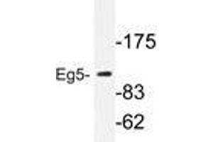 Western blot analysis of Eg5 antibody in extracts from COLO205 cells. (KIF11 antibody)