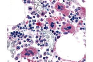 Anti-P2RY12 / P2Y12 antibody IHC of human bone marrow, megakaryocytes. (P2RY12 antibody  (Extracellular Domain))