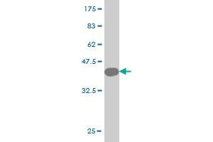 Western Blot detection against Immunogen (40. (CYB5A antibody  (AA 1-134))