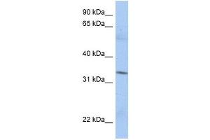 MRPL15 antibody used at 1 ug/ml to detect target protein. (MRPL15 antibody  (N-Term))