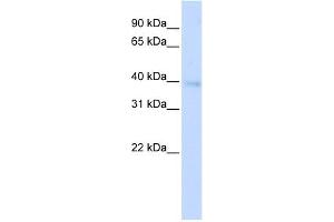WB Suggested Anti-HOXA11 Antibody Titration: 0. (Homeobox A11 antibody  (Middle Region))