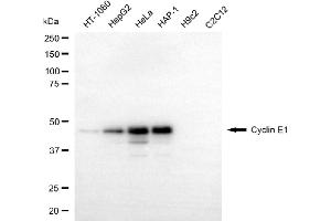 Western blotting analysis using cyclin E1 antibody (ABIN7798198).