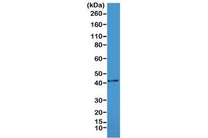 Western Blotting (WB) image for anti-Actin, alpha 2, Smooth Muscle, Aorta (ACTA2) (N-Term) antibody (ABIN4953290)