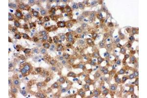 IHC testing of FFPE rat liver with Transferrin antibody. (Transferrin antibody)