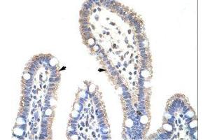 Image no. 1 for anti-Methyltransferase Like 3 (METTL3) (N-Term) antibody (ABIN202783) (METTL3 antibody  (N-Term))