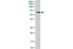 CDR2 monoclonal antibody (M01), clone 4F5 Western Blot analysis of CDR2 expression in HeLa . (CDR2 antibody  (AA 296-404))