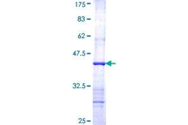 alpha-Mannosidase II Protein (AA 1045-1144) (GST tag)