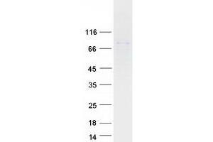 TDRD3 Protein (Myc-DYKDDDDK Tag)