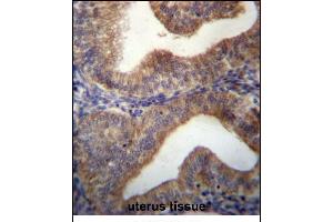 SLC29A3 Antibody (N-term) (ABIN656792 and ABIN2846011) immunohistochemistry analysis in formalin fixed and paraffin embedded human uterus tissue followed by peroxidase conjugation of the secondary antibody and DAB staining. (SLC29A3 antibody  (N-Term))